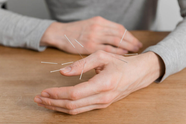 Does Dry Needling Hurt Pain Level And What You Need To Know Does dry needling hurt pain level and what you need to know