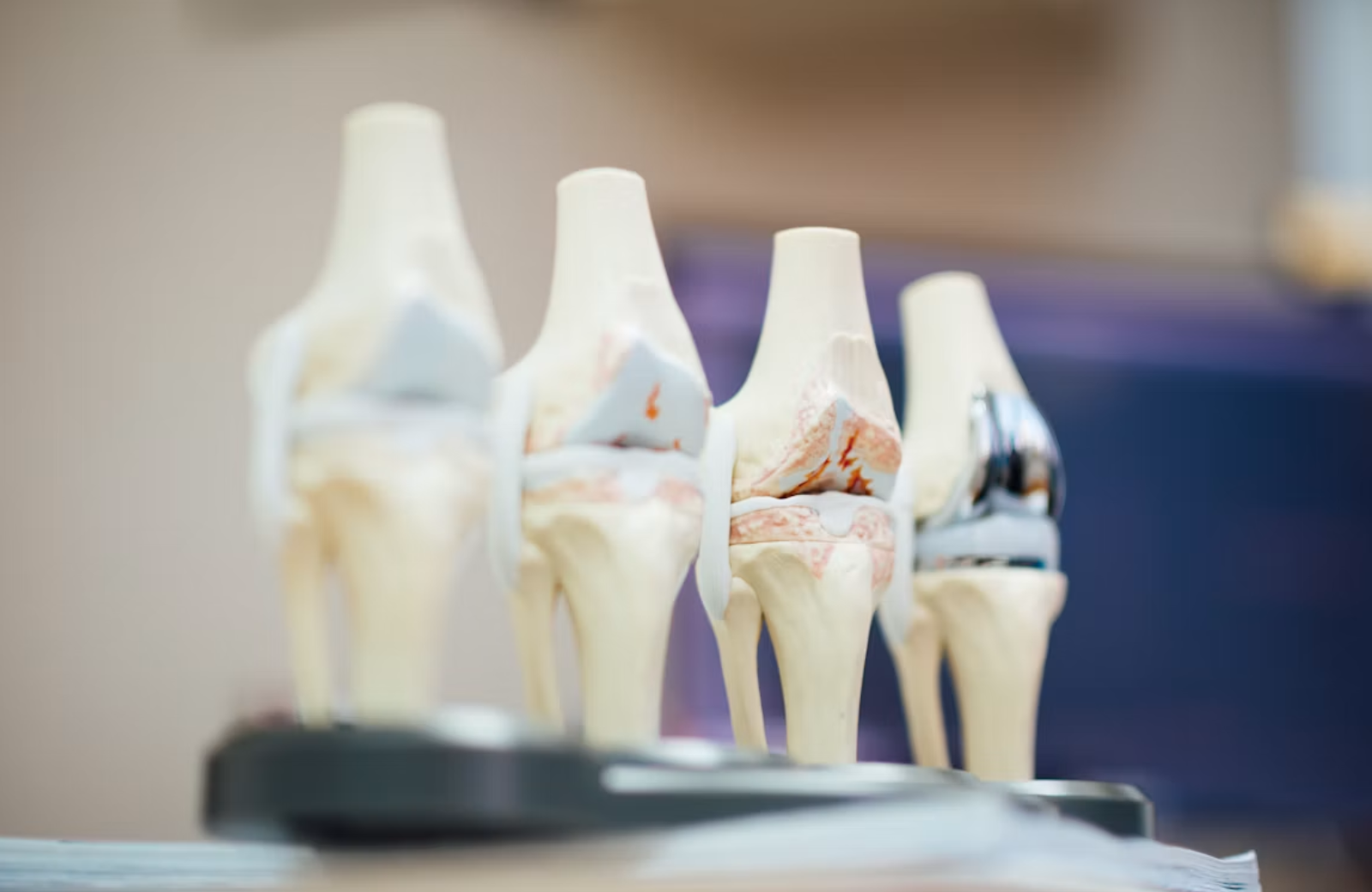 Patellar Tendonitis Exercises That Actually Help Your Knee Heal 1